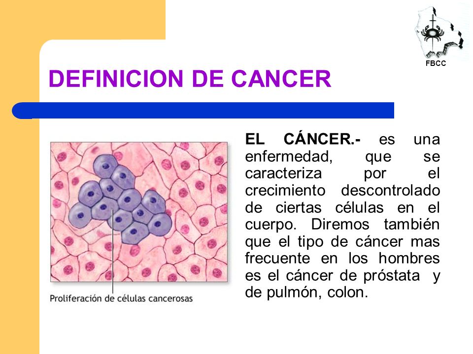 ¿Cuál es la definición de cáncer de próstata?